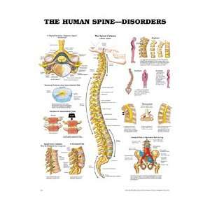 1587794438 PT# 1587794438  Chart Anatomical Human Spine 20x26 Ea by 