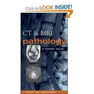 CT & MRI Pathology  A Pocket Atlas BY GRAY  