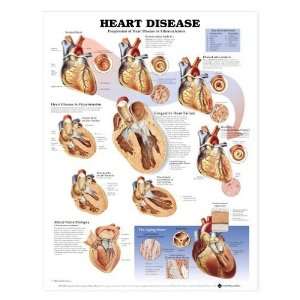 Heart Disease Chart  Industrial & Scientific