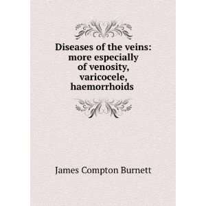   , Haemorrhoids, and Varicose Veins James Compton Burnett Books