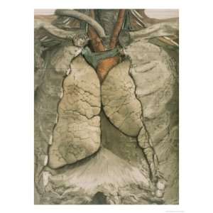  Lung Heart Chest Cavity Cutaway Giclee Poster Print