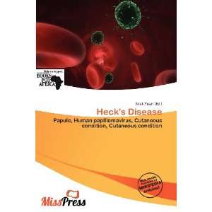  Hecks Disease (9786200734051) Niek Yoan Books