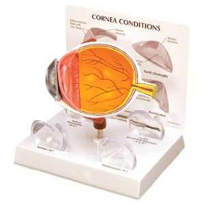 GPI Anatomical Cornea Eye Model  Industrial & Scientific